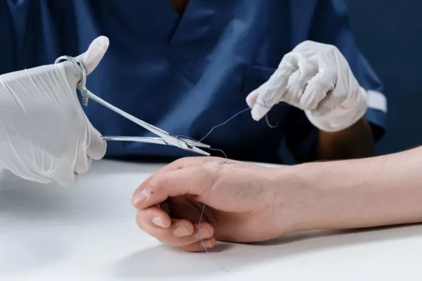 Nurse putting stiches on injured hand due to dog bite injury