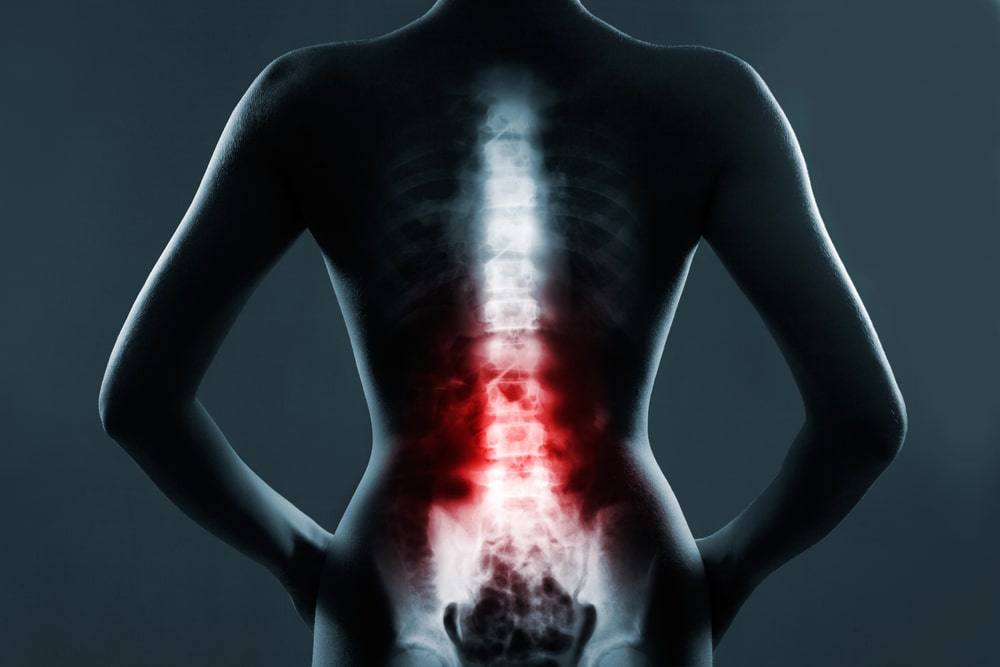 back injury lawyer West Jordan, UT